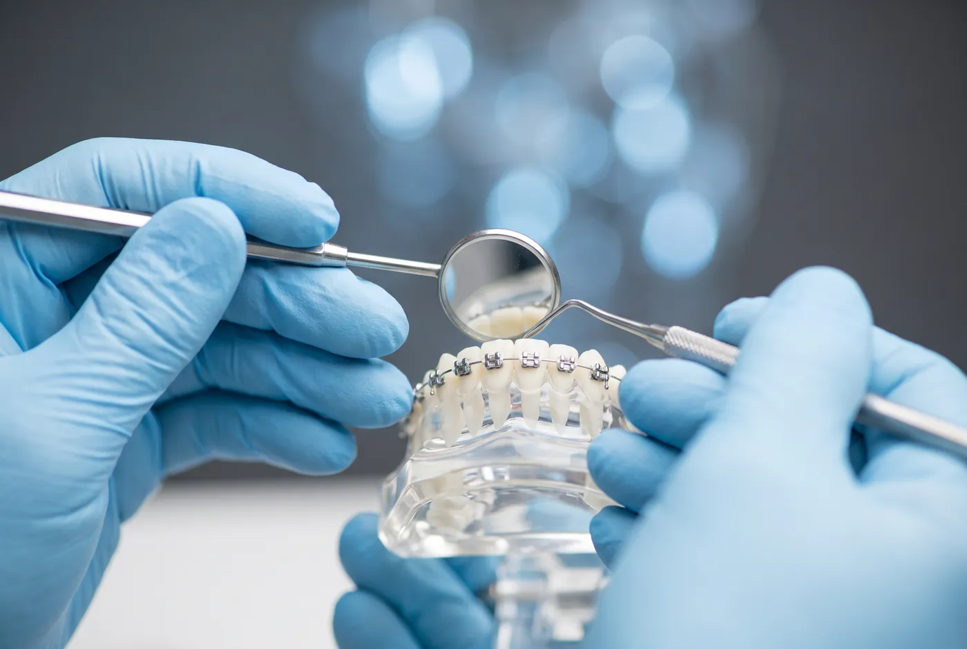 Modelo de ortodoncia con brackets revisado con espejo e instrumental
